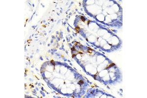 Immunohistochemistry (IHC) image for anti-Secretagogin, EF-Hand Calcium Binding Protein (SCGN) antibody (ABIN7270178)