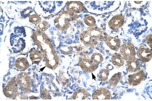 Rabbit Anti-CBX 4 Antibody Catalog Number: ARP30002 Paraffin Embedded Tissue: Human Kidney Cellular Data: Epithelial cells of renal tubule Antibody Concentration: 4. (CBX4 抗体  (N-Term))