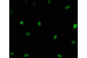 Immunofluorescence staining of U251 cells with ABIN7174212 at 1:166, counter-stained with DAPI. (LSM11 抗体  (AA 1-141))