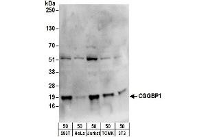 anti-CGG Triplet Repeat Binding Protein 1 (CGGBP1) (AA 100-150) antibody