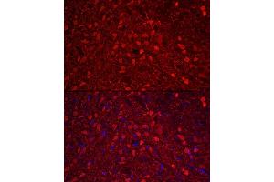 Immunofluorescence (IF) image for anti-Calbindin 2 (CALB2) (AA 1-271) antibody (ABIN6137849)