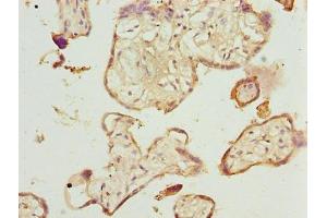 Immunohistochemistry of paraffin-embedded human placenta tissue using ABIN7173063 at dilution of 1:100 (TMEM143 抗体  (AA 8-278))