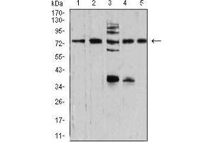 Western blot analysis using SYN1 mouse mAb against NIH/3T3 (1), U251 (2), C6 (3), A549 (4), and MCF-7 (5) cell lysate. (SYN1 抗体  (AA 362-511))