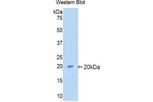 Detection of Recombinant a2PI, Rat using Polyclonal Antibody to Alpha 2-Antiplasmin (a2PI) (alpha 2 Antiplasmin 抗体  (AA 348-491))