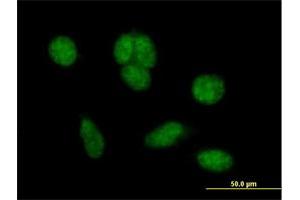 Immunofluorescence of purified MaxPab antibody to C1orf181 on HeLa cell. (ZNHIT6 抗体  (AA 1-470))