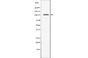 Western blot analysis of extracts from HeLa cells using AMPD2 antibody. (AMPD2 抗体  (N-Term))