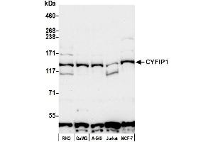 Western Blotting (WB) image for anti-Cytoplasmic FMR1 Interacting Protein 1 (CYFIP1) (AA 1203-1253) antibody (ABIN7451579)