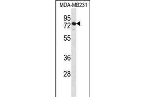 SLFN12 Antibody (Center) (ABIN1538019 and ABIN2849329) western blot analysis in MDA-M cell line lysates (35 μg/lane). (SLFN12 抗体  (AA 192-220))