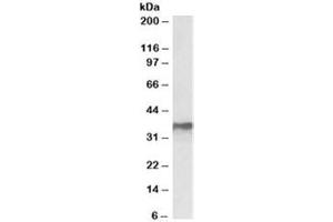 Western blot testing of MCF7 lysate with HNRNPA2B1 antibody at 0. (HNRNPA2B1 抗体)