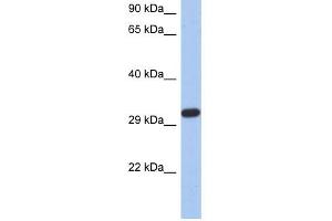 CAPZA3 antibody used at 1 ug/ml to detect target protein. (CAPZA3 抗体)