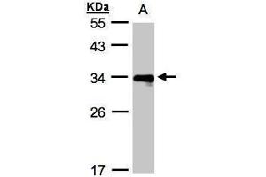 WB Image Sample(30 ug whole cell lysate) A:Raji , 12% SDS PAGE antibody diluted at 1:1000 (HLA-DRB4 抗体  (Center))