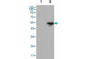 Western blot analysis using LCN1 monoclonal antibody, clone 10B10  against HEK293 (1) and LCN1-hIgGFc transfected HEK293 cell lysate (2).
