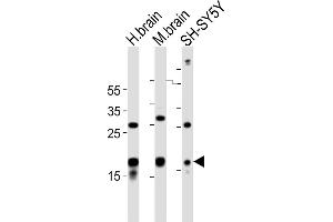 All lanes : Anti-STMN2 Antibody (Center) at 1:1000 dilution Lane 1: human brain lysates Lane 2: mouse brain lysates Lane 3: SH-SY5Y whole cell lysates Lysates/proteins at 20 μg per lane.