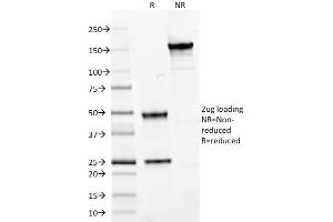 SDS-PAGE Analysis Purified PAX7 Mouse Monoclonal Antibody (PAX7/497). (PAX7 抗体  (AA 301-505))