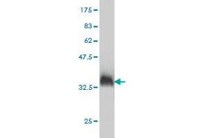 Western Blotting (WB) image for anti-Pyruvate Dehydrogenase Kinase, Isozyme 2 (PDK2) (AA 187-276) antibody (ABIN562160)