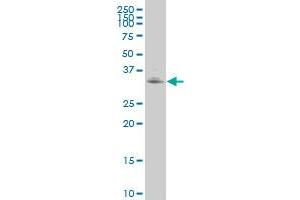 WDR5 polyclonal antibody (A01), Lot # FAK0060414QCS1 Western Blot analysis of WDR5 expression in A-549 . (WDR5 抗体  (AA 16-120))