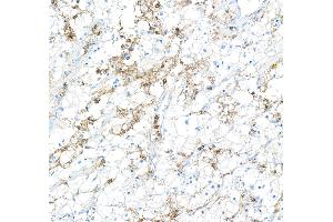 Immunohistochemistry (IHC) image for anti-CD16 (CD16) (AA 21-201) antibody (ABIN7449423)