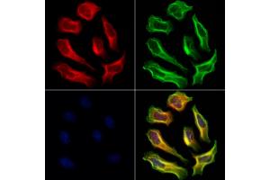 ABIN6264995 and ABIN6273073 staining Hela cells by IF/ICC. (Septin 9 抗体  (C-Term))