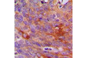 Immunohistochemistry (IHC) image for anti-Collagen, Type I, alpha 2 (COL1A2) (N-Term) antibody (ABIN7295316)