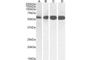 Western Blot using anti-Beta-Tubulin antibody S11B. (Recombinant TUBB 抗体)