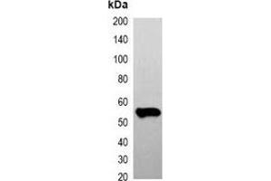Western blot analysis of over-expressed FLAG-tagged protein in 293T cell lysate. (DYKDDDDK Tag 抗体)