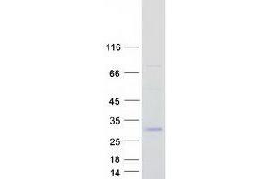 Validation with Western Blot (C1QC Protein (Transcript Variant 2) (Myc-DYKDDDDK Tag))