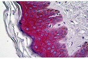 Anti-Gamma Catenin antibody IHC staining of human skin. (JUP 抗体  (C-Term))