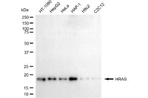 Western blotting analysis using HRAS antibody (ABIN7799000). (HRAS 抗体)