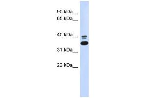 WB Suggested Anti-ABHD7 Antibody Titration: 0. (EPHX4 抗体  (N-Term))