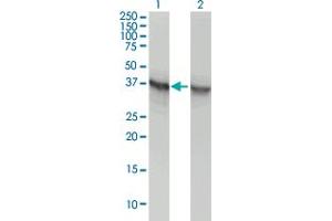 Western Blot analysis of ALDOA expression in transfected 293T cell line by ALDOA monoclonal antibody (M02), clone 3C12-6D11. (ALDOA 抗体  (AA 1-364))