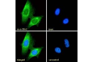 (ABIN185533) Immunofluorescence analysis of paraformaldehyde fixed U251 cells, permeabilized with 0. (Tryptophan Hydroxylase 2 抗体  (Internal Region))