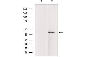 Western blot analysis of extracts from rat brain, using TMOD4 antibody. (Tropomodulin 4 抗体  (Internal Region))
