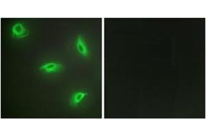 Immunofluorescence analysis of HeLa cells, using TNF14 Antibody. (TNFSF14 抗体  (AA 51-100))