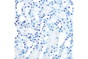 Immunohistochemistry of paraffin-embedded mouse kidney using M/M/ML1 Rabbit mAb (ABIN7268354) at dilution of 1:100 (40x lens). (MAD2L1 抗体)