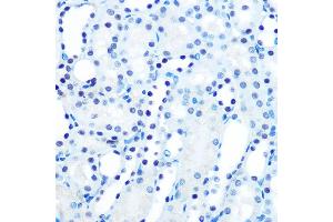 Immunohistochemistry of paraffin-embedded mouse kidney using M/M/ML1 Rabbit mAb (ABIN7268354) at dilution of 1:100 (40x lens).