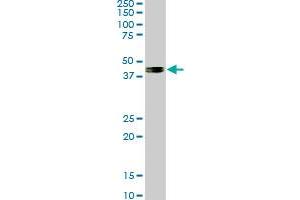 SMAD7 monoclonal antibody (M06), clone 4E1. (SMAD7 抗体  (AA 160-260))