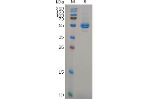 SDS-PAGE (SDS) image for Interleukin 11 (IL11) (AA 22-199) protein (Fc Tag) (ABIN7092795)