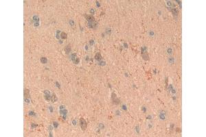Used in DAB staining on fromalin fixed paraffin- embedded brain tissue (FGF20 抗体  (AA 1-211))