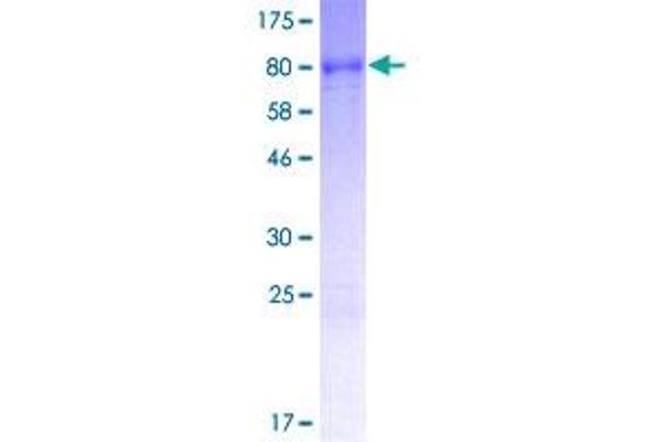 MEX3C Protein (AA 1-464) (GST tag)