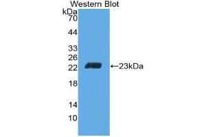 Detection of Recombinant CD6, Mouse using Polyclonal Antibody to Cluster Of Differentiation 6 (CD6) (CD6 抗体  (AA 30-204))