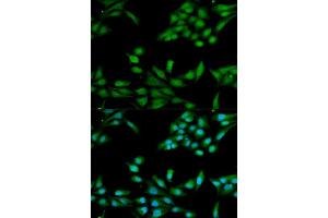 Immunofluorescence analysis of HeLa cell using MSH2 antibody. (MSH2 抗体  (AA 1-300))