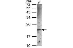 WB Image Sample (30 ug of whole cell lysate) A: A549 12% SDS PAGE antibody diluted at 1:1000 (FTH1 抗体  (Center))