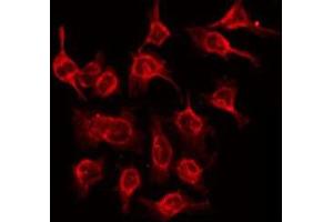 ABIN6275405 staining Hela by IF/ICC. (NDRG3 抗体  (Internal Region))