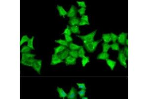 Immunofluorescence analysis of A549 cells using HAPLN1 Polyclonal Antibody (HAPLN1 抗体)