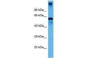 Host:  Mouse  Target Name:  P4HB  Sample Tissue:  Mouse Small Intestine  Antibody Dilution:  1ug/ml (P4HB 抗体  (C-Term))