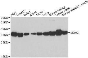 Western blot analysis of extracts of various cell lines, using MDH2 antibody. (MDH2 抗体  (AA 59-338))