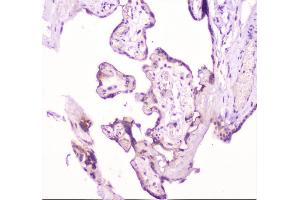 IHC analysis of TANK using anti-TANK antibody (ABIN6719508). (TANK 抗体)