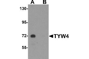 Western blot analysis of TYW4 in rat brain tissue lysate with TYW4 antibody at 1 µg/mL in (A) the absence and (B) the presence of blocking peptide. (LCMT2 抗体  (N-Term))