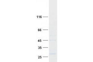 Western Blotting (WB) image for Adaptor-Related Protein Complex 3, sigma 2 Subunit (AP3S2) protein (Myc-DYKDDDDK Tag) (ABIN2714772)