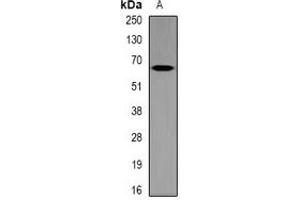 Western blot analysis of MT-ND5 expression in mouse brain (A) whole cell lysates. (MT-ND5 抗体)